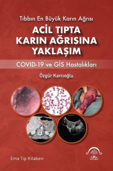 Acil Tıpta Karın Ağrısına Yaklaşım - Covid-19 ve GİS Hastalıkları