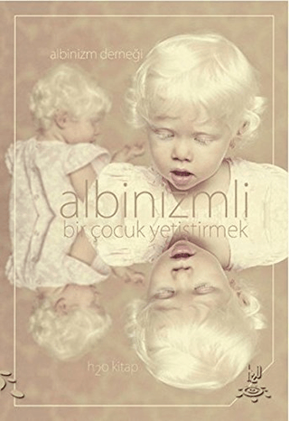 Albinizmli Bir Çocuk Yetiştirmek