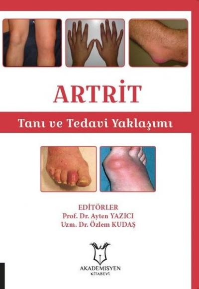 ARTRİT - Tanı ve Tedavi Yaklaşımı Ayten Yazıcı