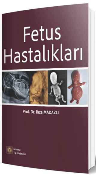 Fetus Hastalıkları Rıza Madazlı