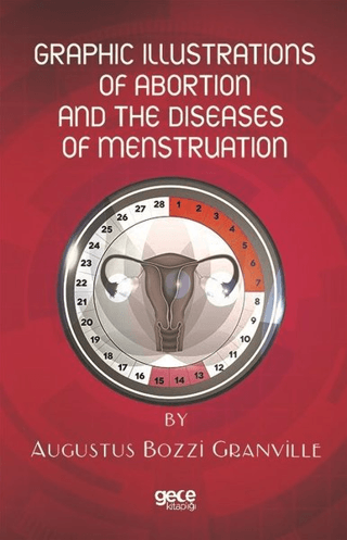 Graphic Illustrations Of Abortion And The Diseases Of Menstruation