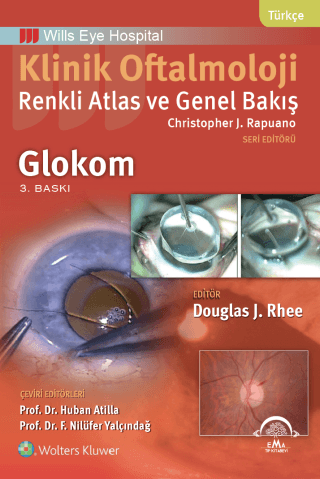Klinik Oftalmoloji: Renkli Atlas ve Genel Bakış - Glokom