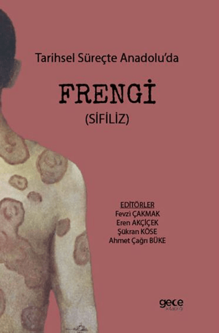 Tarihsel Süreçte Anadolu’da Frengi