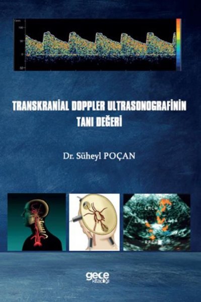 Transkranial Doppler Ultrasonografinin Tanı Değeri